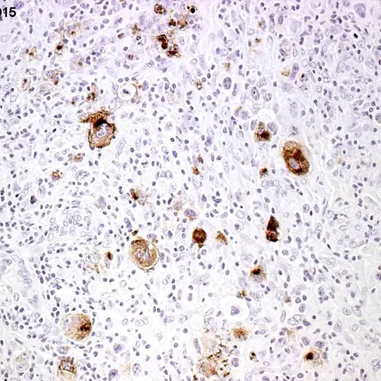 IHC - Cluster of Differentiation 15 (CD15)